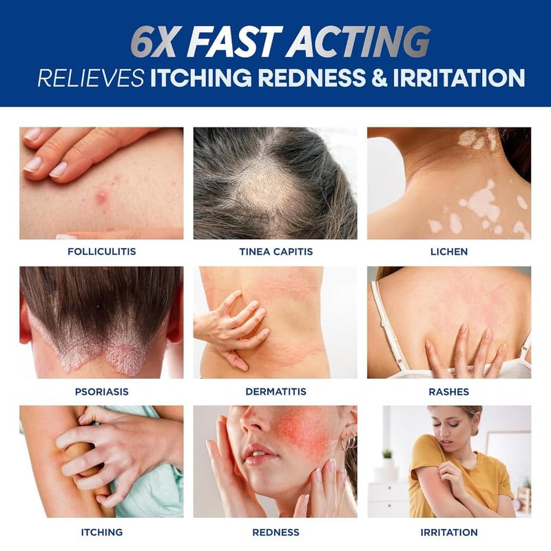 Folliculitis Treatment Cream — Advanced Antifungal with Tea Tree Oil